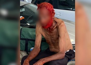 Caso de idoso que teve cabelo e barba tingidos de vermelho em troca de doação pode configurar crime: 'Ofende a dignidade', diz promotor