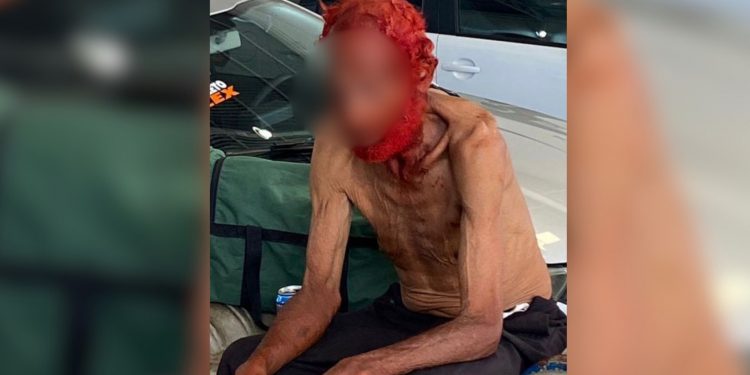 Caso de idoso que teve cabelo e barba tingidos de vermelho em troca de doação pode configurar crime: 'Ofende a dignidade', diz promotor